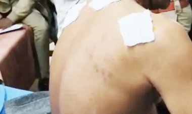 ગીરગઢડા તાલુકાના ઇટવાયા ગામની સીમમાં બાજરાના પાકને પાણી વાળતા આધેડ ખેડૂત ઉપર દીપડાએ હુમલો કર્યો