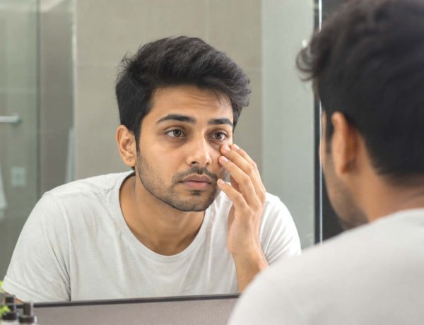 આંખોની નીચે કાળા ડાઘ કેમ દેખાય છે? માત્ર ઊંઘની કમી જ જવાબદાર નથી
