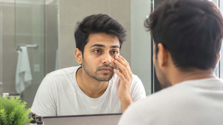 આંખોની નીચે કાળા ડાઘ કેમ દેખાય છે? માત્ર ઊંઘની કમી જ જવાબદાર નથી