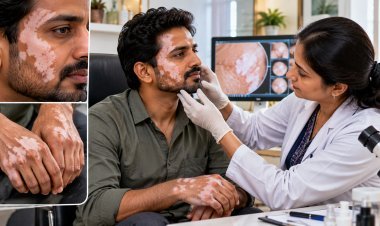 ત્વચા પર અચાનક સફેદ ડાઘ દેખાય છે? દરેક સફેદ ડાઘ Vitiligo નથી, તપાસથી કારણ જાણવું જરૂરી